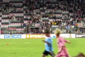 术细节打磨 术细节打磨